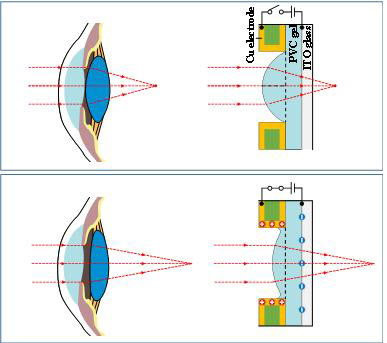 사람의 눈 구조와 초박막 인공수정체 구조
